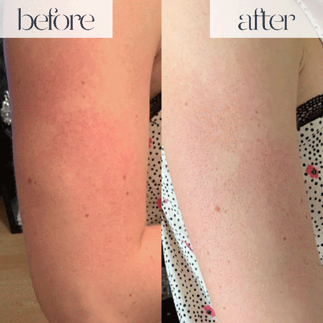 Before and After shots from using the product