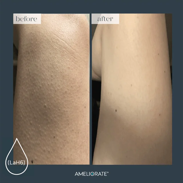 Before/After