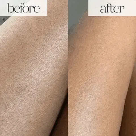 Image 1-5: Before and after model shots